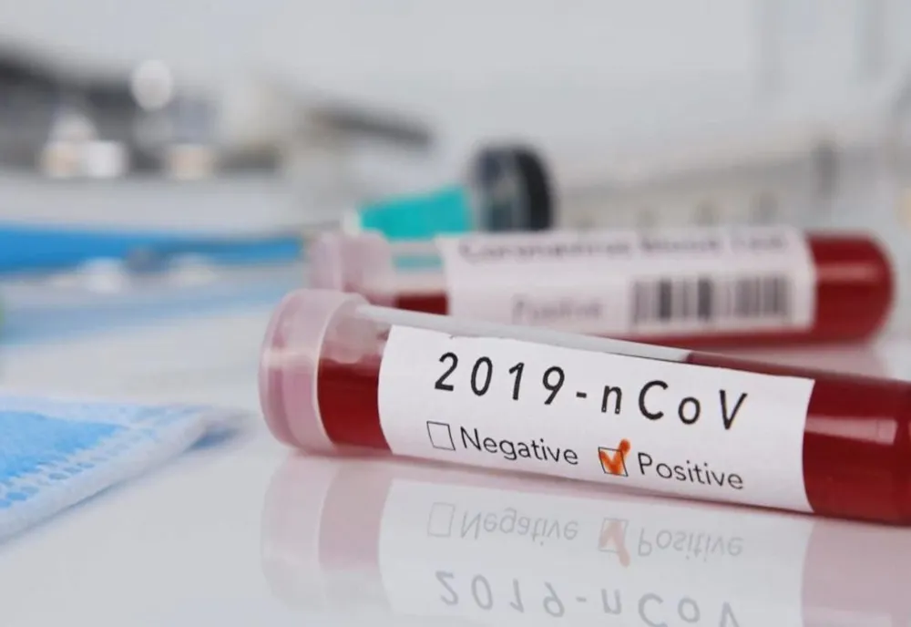 Coronavirus: al 13-lea deces, femeie din Caraș Severin, adusă la Timișoara