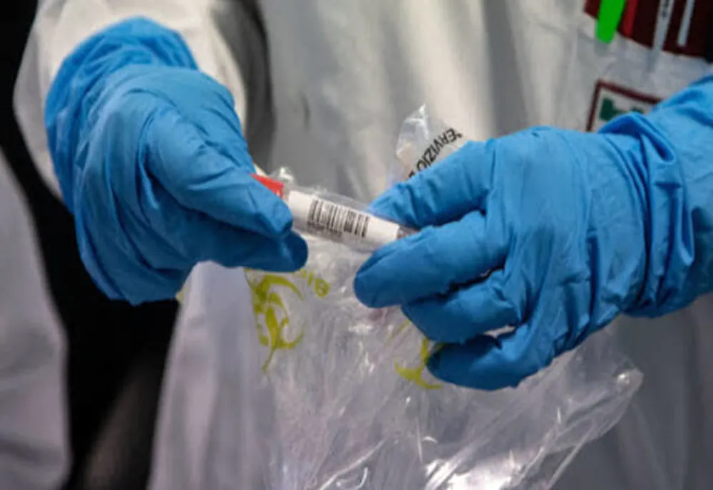 Nouă focare de coronavirus, în Timiș. Cel mai mare, la o firmă de prelucrare a cărnii