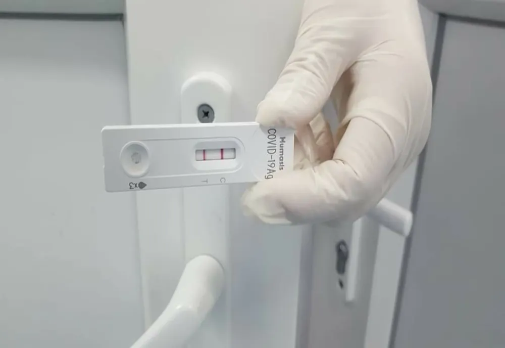 Scade numărul celor care vor să-și facă testul pentru coronavirus pe banii lor