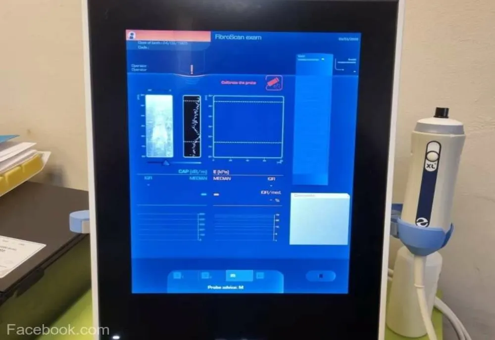 Timiş: Spitalul ''Victor Babeş'' s-a dotat cu un FibroScan ce înlocuieşte biopsia hepatică cu o investigaţie nedureroasă