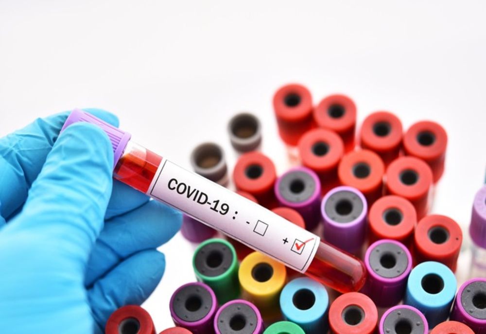Coronavirus în România, bilanț oficial 5 iulie. Situația în vestul țării