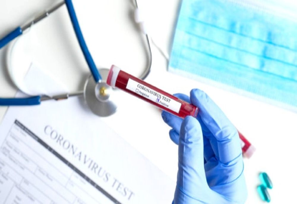 Aproape 73.000 de teste de coronavirus realizate în Timiș de la începutul pandemiei