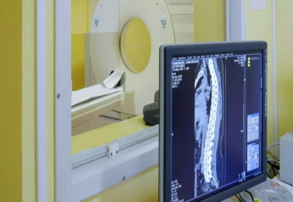 Computerul tomograf de la Spitalul Victor Babeș din Timișoara a fost reparat