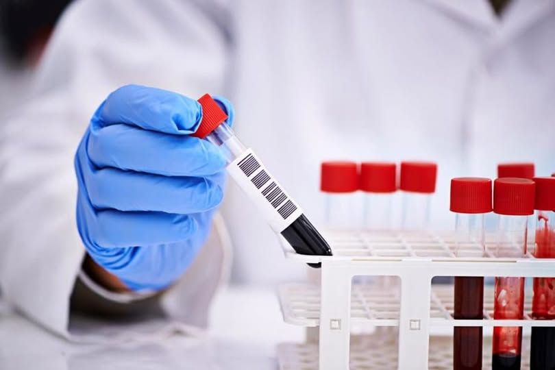 ANALIZE MEDICALE GRATUITE, PE TOT PARCURSUL LUNII LA SPITALUL ”VICTOR BABEȘ” TIMIȘOARA