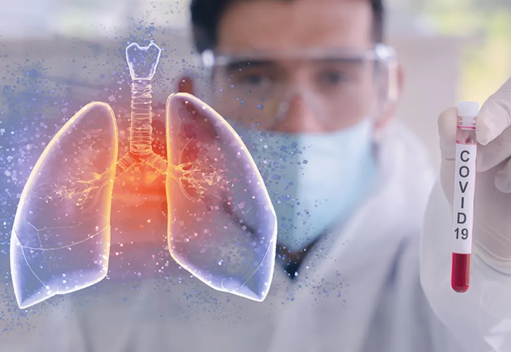 Experți români, avertisment dur: noua tulpină de Covid-19, cu 50% mai infecțioasă