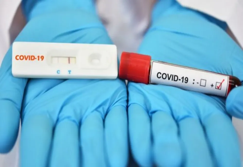 Testele rapide antigen pot fi făcute în farmacii