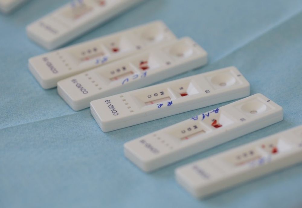 Proiect de testare în masă a populației, aprobat de Consiliul Local Dumbrăvița