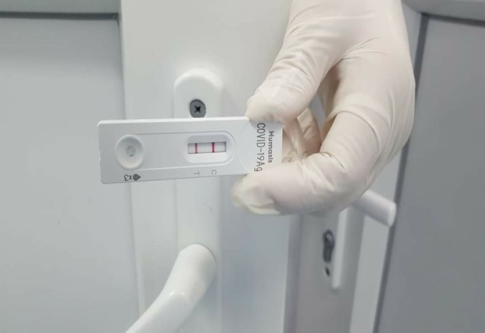 Scade numărul celor care vor să-și facă testul pentru coronavirus pe banii lor