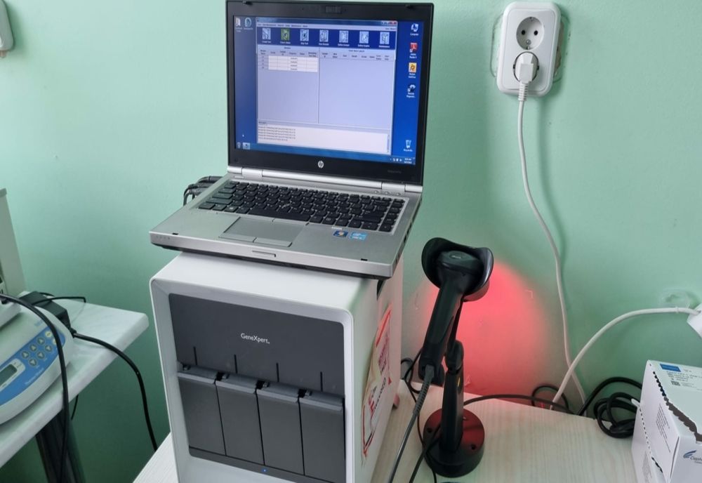 Tuberculoza poate fi depistată în mai puțin de două ore la Timișoara