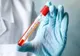 Zeci de teste pentru coronavirus sunt prelucrate la Timișoara