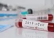 Coronavirus: al 13-lea deces, femeie din Caraș Severin, adusă la Timișoara
