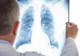 Dosar penal pentru o femeie, după ce a mers să-și facă o radiografie