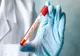 Coronavirus în România, 29 mai. Bilanț actualizat, date oficiale: 191 de cazuri noi. Câți români mai sunt la Terapie Intensivă
