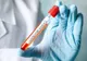 Niciun caz nou de coronavirus în Timiș. Doar 15 persoane mai sunt internate
