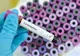 Două focare de coronavirus au fost închise, în Timiș, au apărut însă altele noi