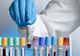 Suspinciune de coronavirus infirmată, la Timișoara