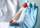 Niciun caz nou de coronavirus în Timiș. Doar 15 persoane mai sunt internate