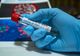 Focare active de coronavirus, în județul Timiș